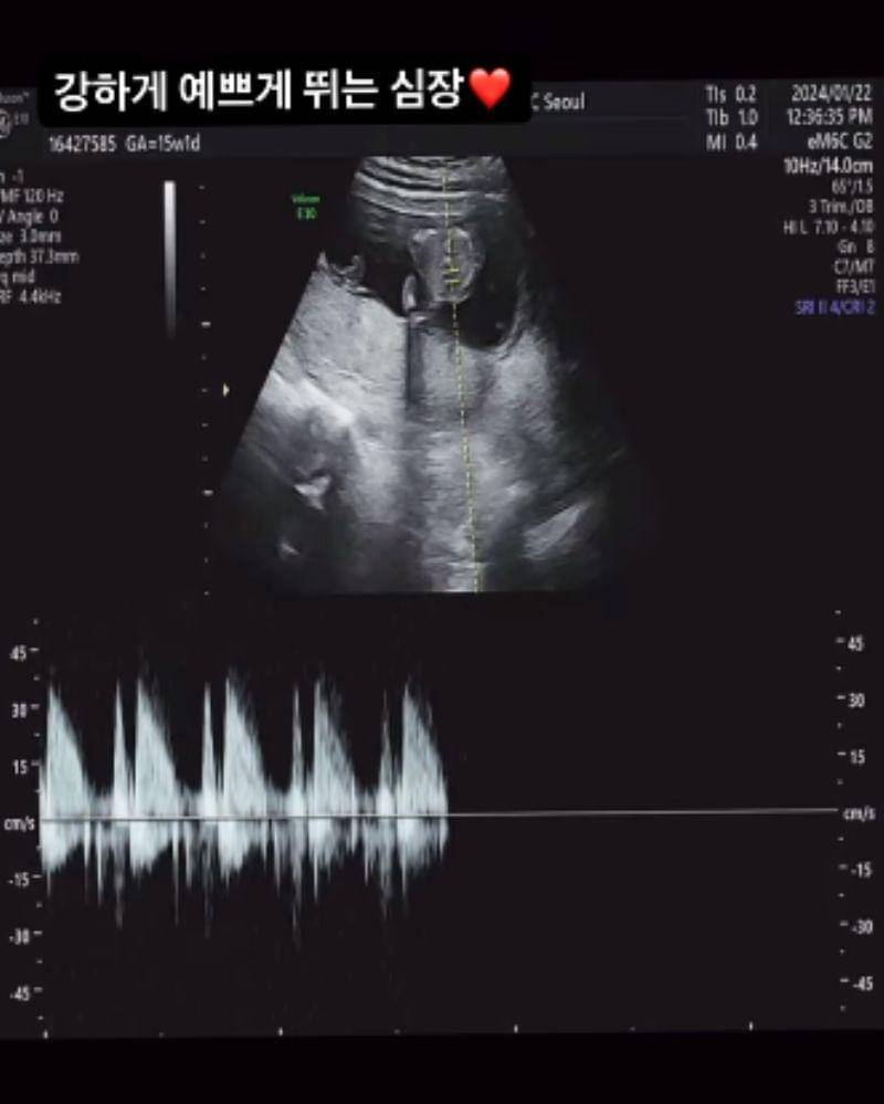 Instagram.com/ayamiu1209